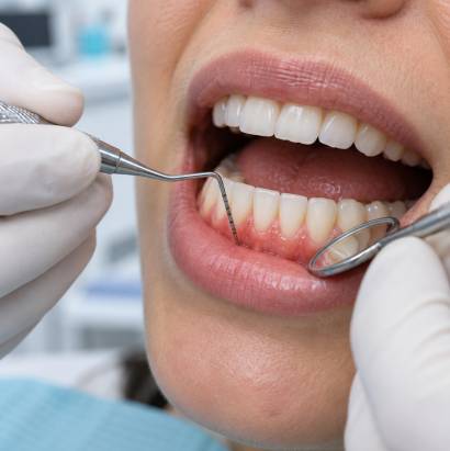 periodontoloji